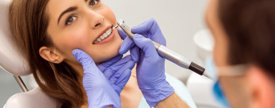 Cosmetic Dentistry Trends Transforming Smiles