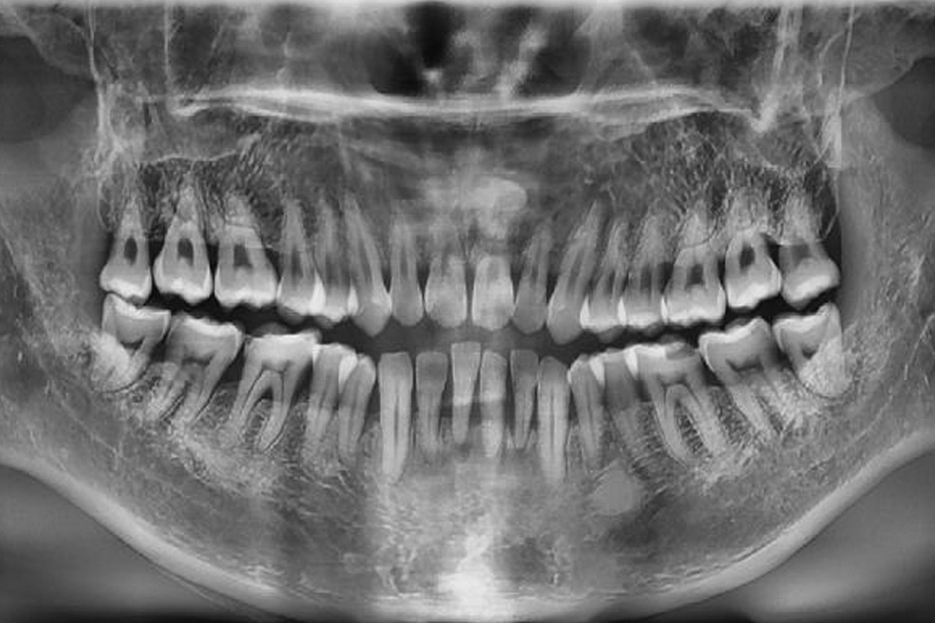 Advanced Imaging Solution 