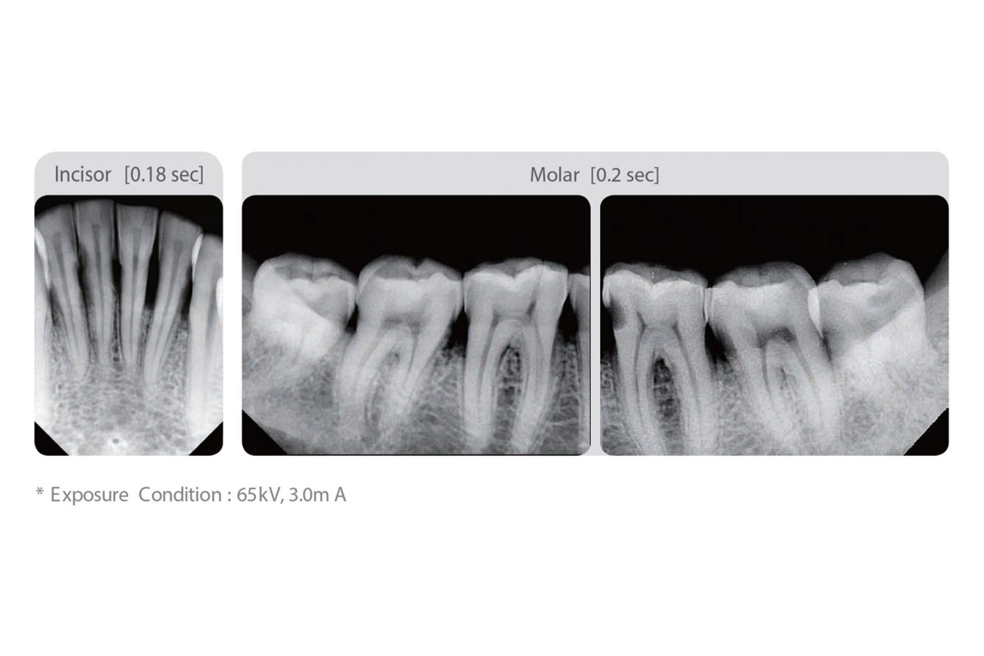 Secure Clear Images With A 0.4mm Focal Spot
