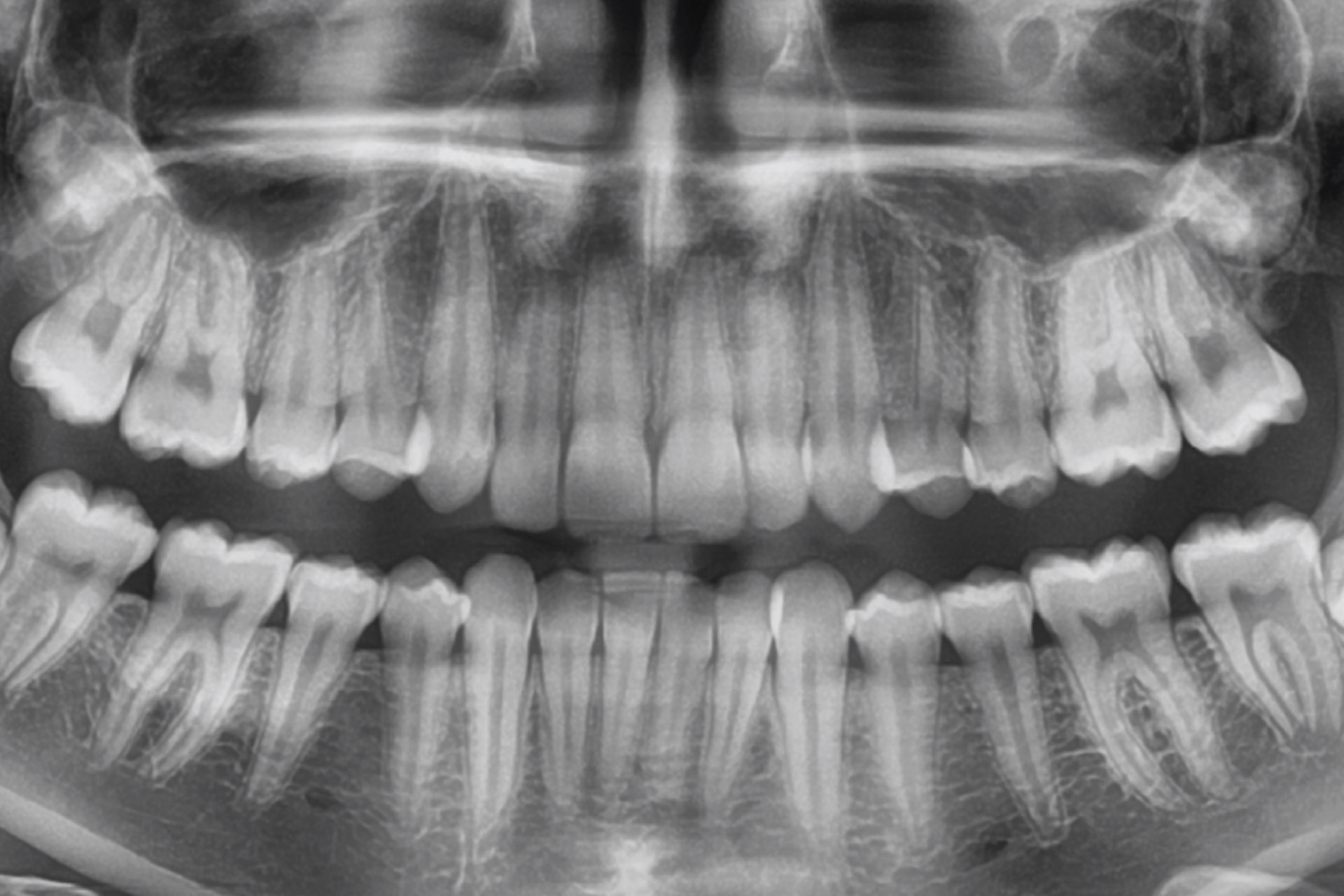 dental imaging of teeth