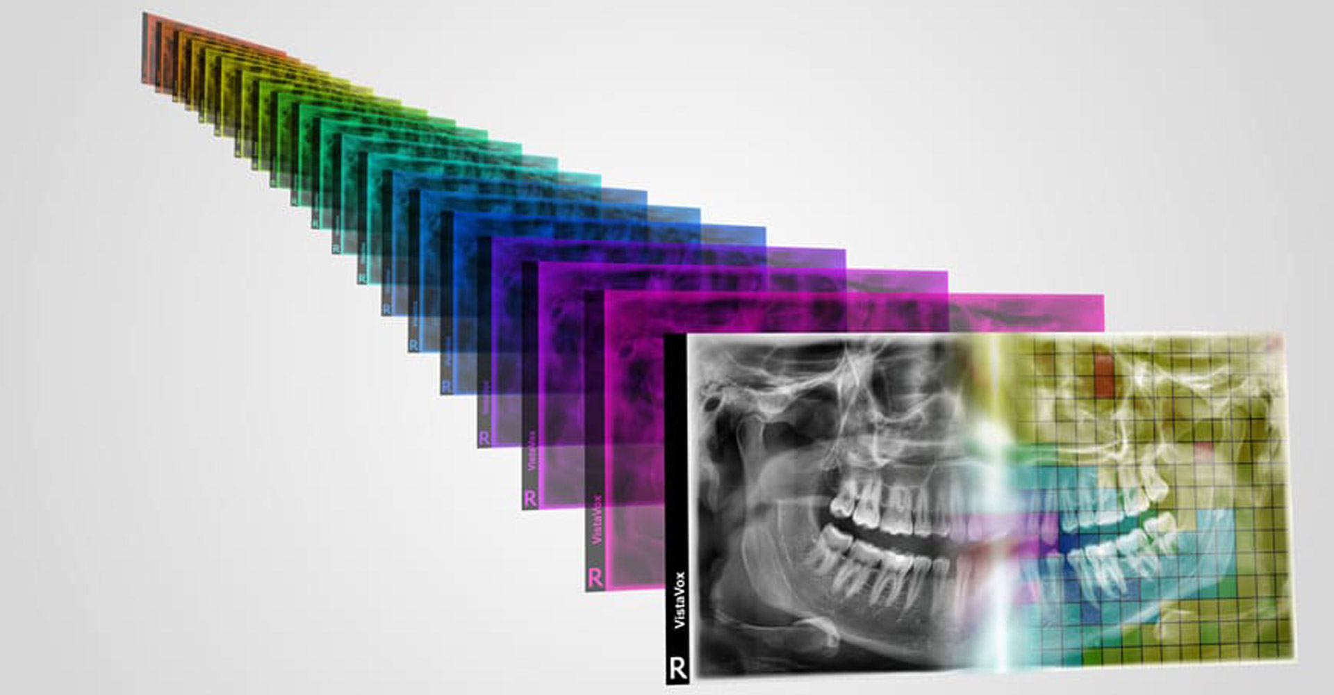 Durr VistaVox S img 3