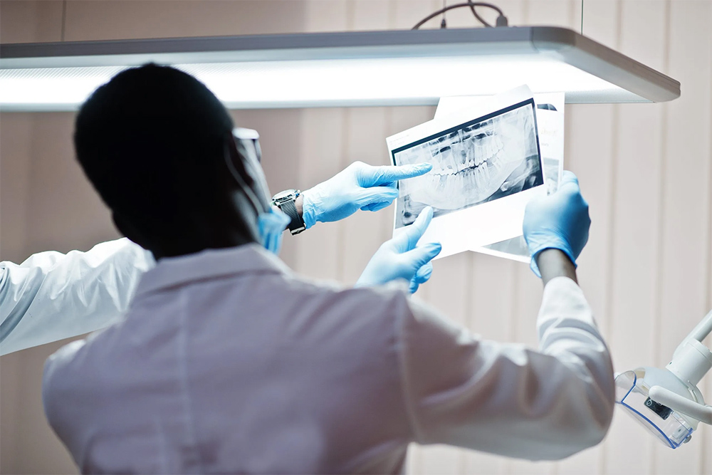 What Are the Major Roles of CBCT in Implant Dentistry?